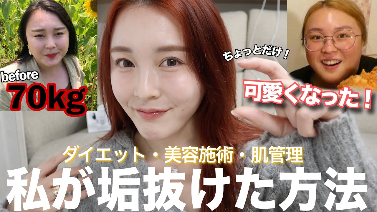 【垢抜け】元70kg超えのデブが可愛くなった方法🌱(ダイエット,整形,肌管理)