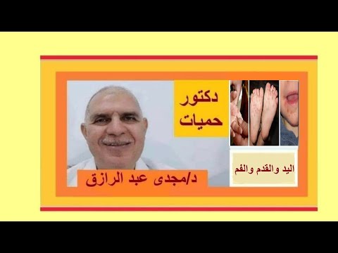 فيديو: 3 طرق لعلاج اليد والقدم والفم