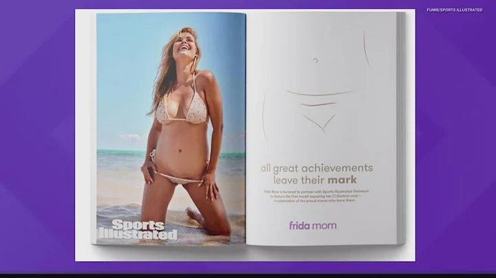 Model with C-section scar graces cover of Sports I...