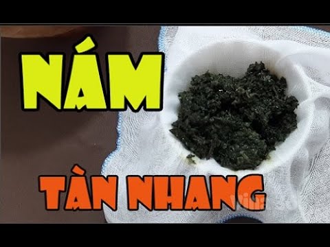 Nám tàn nhang nặng đến mấy cũng tự biến mất nếu lấy lá tía tô làm theo cách này