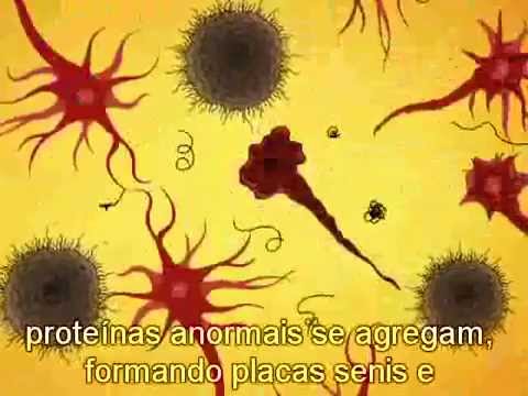 As fases da doença de Alzheimer