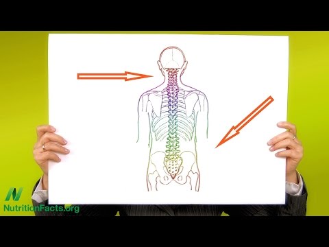 Videó: Osteoporosis: Csontok Egészsége és Menopauza