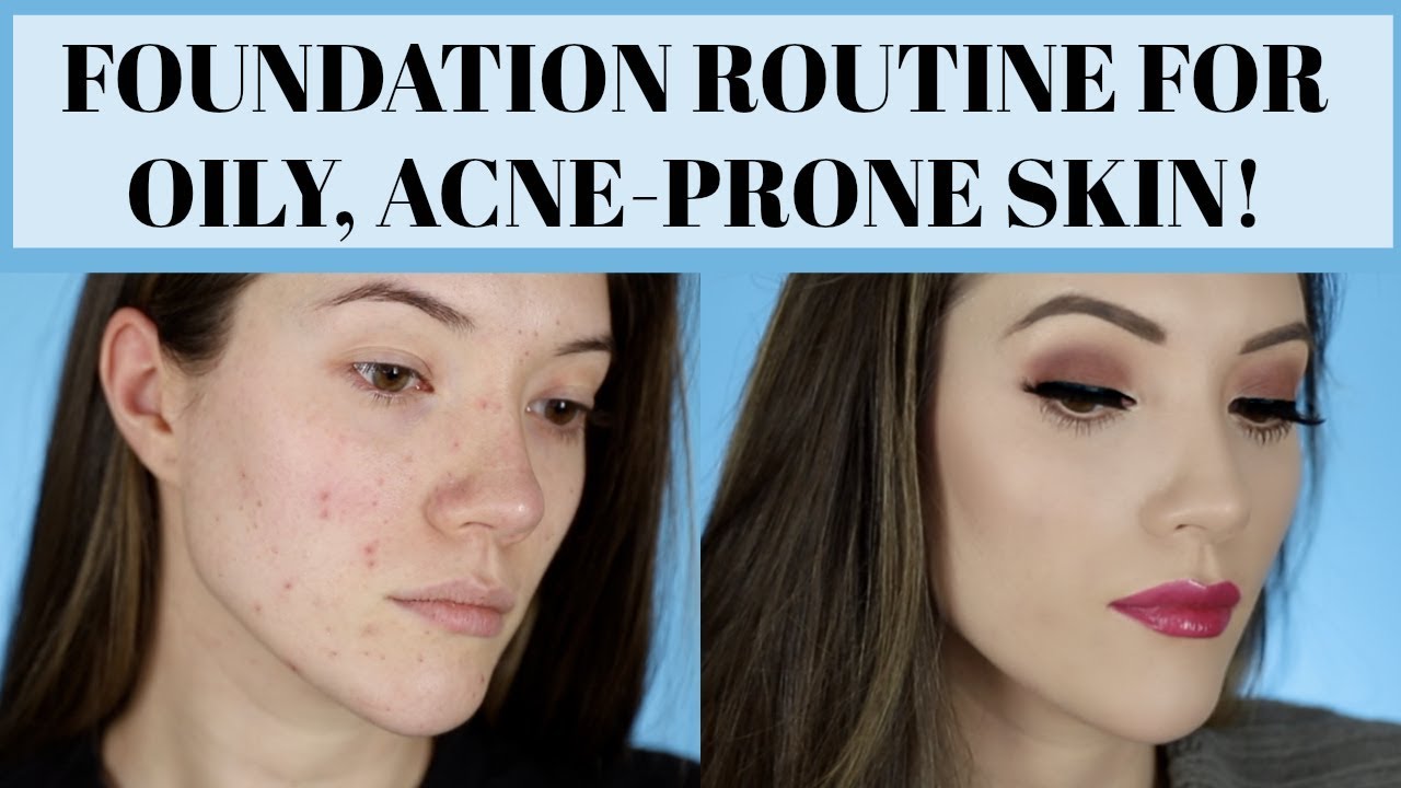 FOUNDATION ROUTINE FOR OILY, ACNE-PRONE SKIN (Long Lasting & Full Coverage) | Blair Fowler