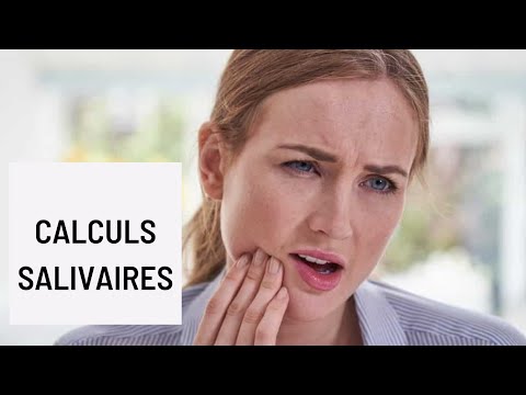 Vidéo: Pourquoi avez-vous des calculs salivaires ?