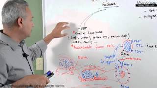 Immunology Lecture 16 - Type IV Hypersensitivity Reactions