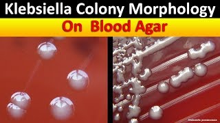 Klebsiella Colony Morphology On Blood Agar