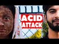 Acid attackbuda vs budi nepali heart touching short film sns entertainment
