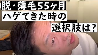 生え際の魔術師 Youtube