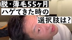 生え際の魔術師 Youtube
