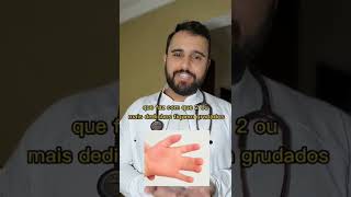 Dedos Grudados Sindactilia