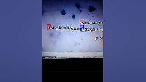 Malaria Detection using TensorFlow Lite