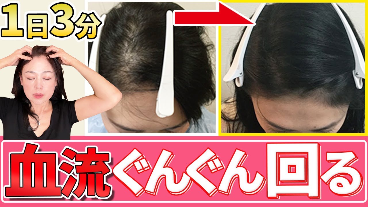 Hair Growth] Prevent thinning hair in just 5 minutes a day! We'll