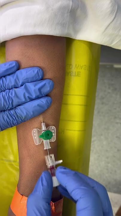 Forearm iv cannulation ! #ivcannulation
