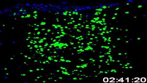 Spatiotemporal Basis of Innate and Adaptive Immunity in Secondary Lymphoid Tissue: Video 10