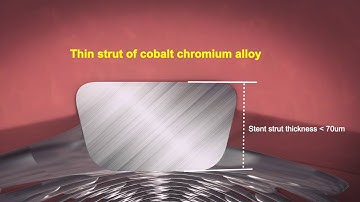 Genoss DES Introduction Video