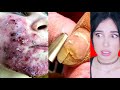 TRATAMIENTOS de BELLEZA EXTREMOS 2 | Mariale