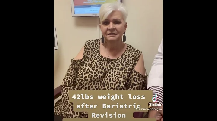 Bariatric Revision after gastric bypass