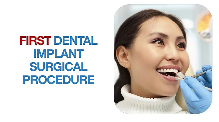 Chandler Dental Implant Procedure