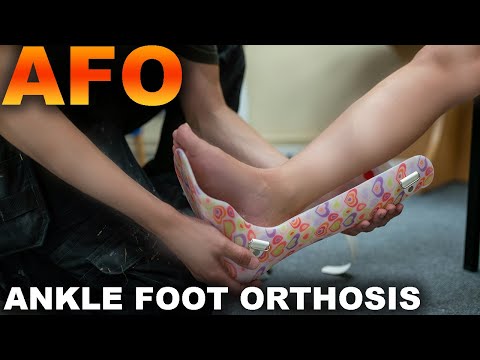 FROM WHEELCHAIR TO WALKING-TRUE JOURNEY (UNSTOPPABLE ME)