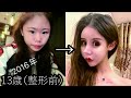 なぜ??16歳で100回以上の整形手術を受けた中国人インフルエンサーの真実