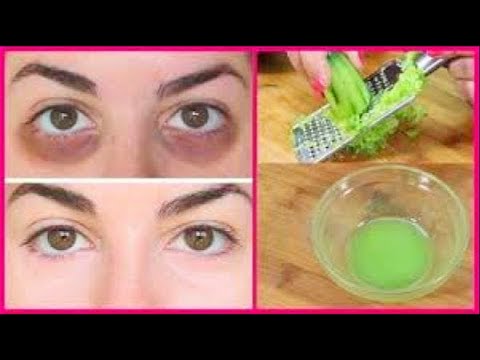 Omg 😱 apply it just every night | remove dark circles overnight super beauty channel