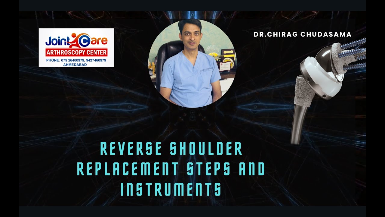 Reverse Shoulder Replacement - Instruments and Steps