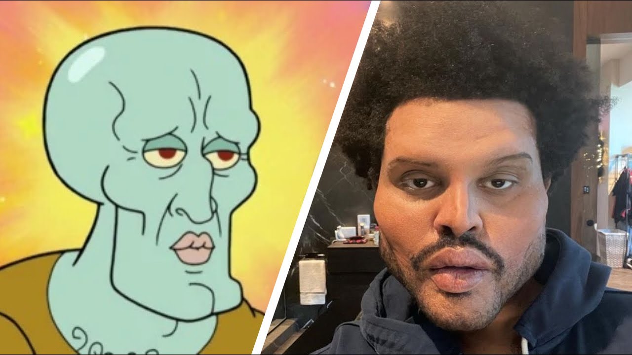 The Weeknd plastic surgery, Plastic surgery face, The Weeknd plastic face s...