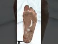 Wounded Foot Recovery ASMR | From Disaster to Perfection #shorts #asmr #toonishasmr
