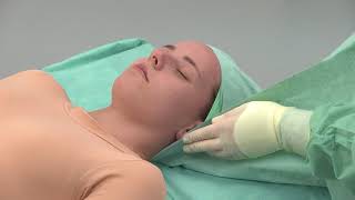 Application Video Raucodrape® Head Set II (EN)
