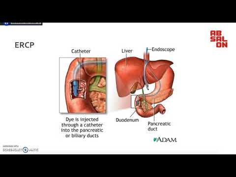 Video: Irritabilitet: Årsager, Symptomer Og Diagnose