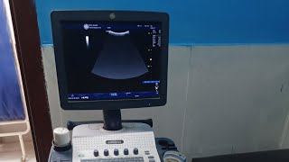 USG machine LOGIC V3 small overview for examination #shortvideo #ultrasound @Quranicblossoms-u7e 