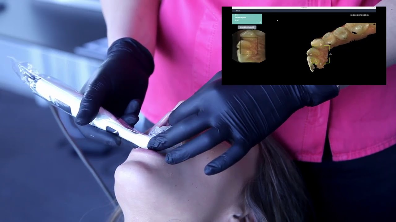 Condor Intra Oral Scanner - Decisamente diverso