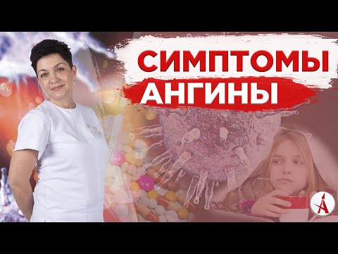 Симптомы ангины