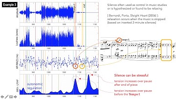 EHRA2020: Cardiac Response to Live Music Performance: Effect of large-scale musical structure ...