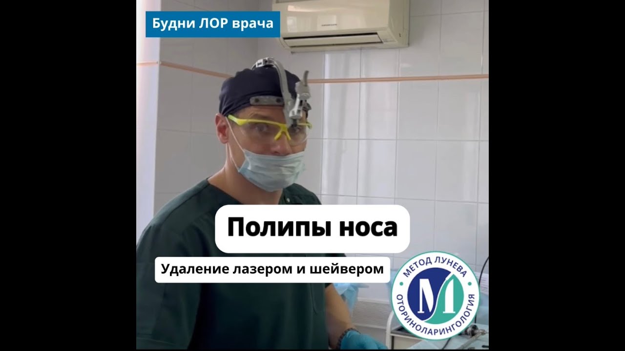 Полипы носа - удаление лазером и шейвером.