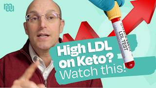 Rethinking Cholesterol Risk: What Lean Mass Hyper-Responders Reveal Wealth