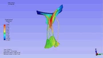 Finite element model of a mitral valve