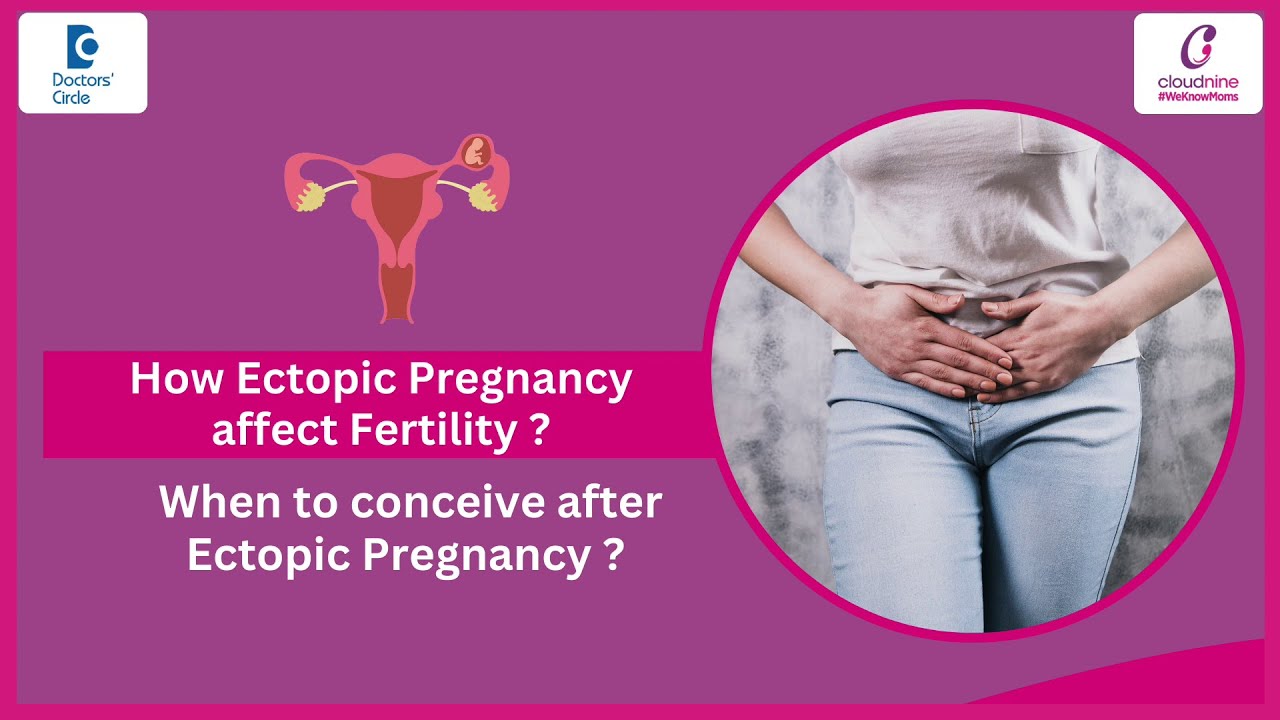 How Soon Can You Try To Conceive After Ectopic Pregnancy