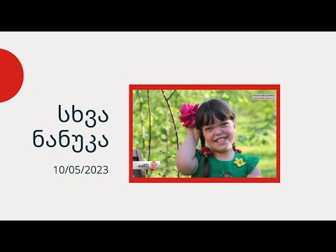 სხვა ნანუკა - აქონდროპლაზიის დიაგნოზის მქონე ბავშვები