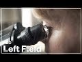 Does Parasitic Skin Disease - Morgellons - Even Exist? | NBC Left Field