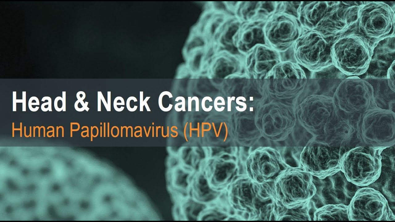 Human Papilloma Virus Induced Head and Neck Cancer, Dr. Peter Spafford ...