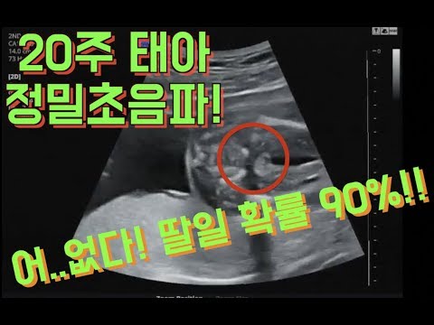 임신초기선물