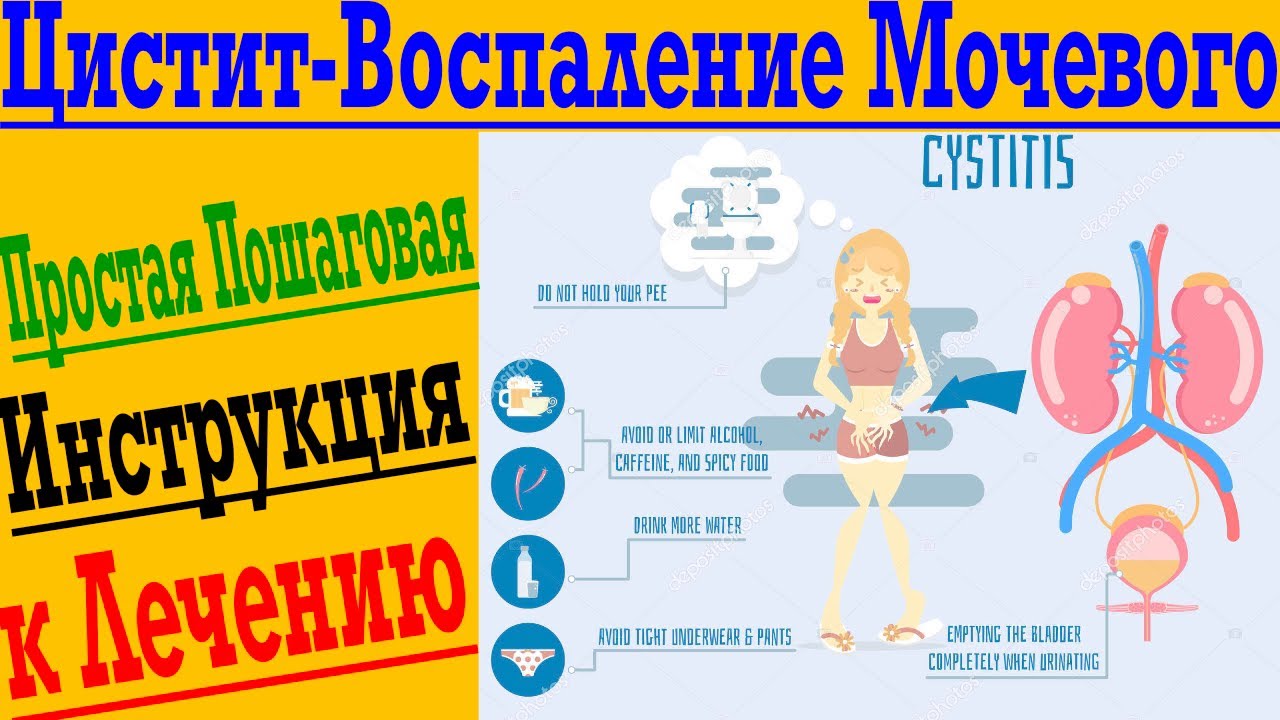 Цистит – воспаление мочевого пузыря ! Простая инструкция к лечению ...