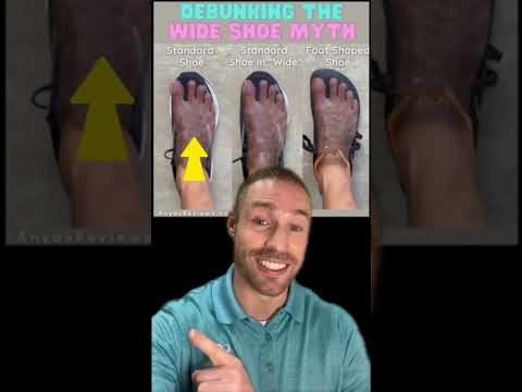 Video: ¿Los chacos le quedan a los pies anchos?