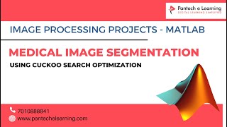 Medical Image Segmentation using  Cuckoo Search Optimization