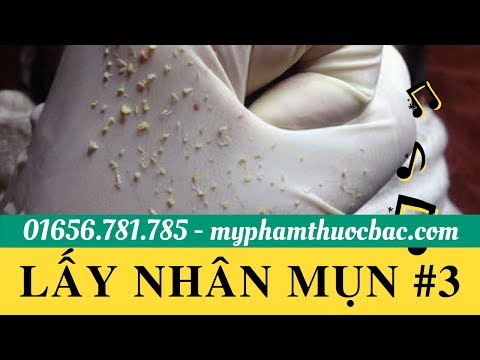 D'Vi Beauty | Lấy nhân mụn và máu thâm #3 | myphamthuocbac.com