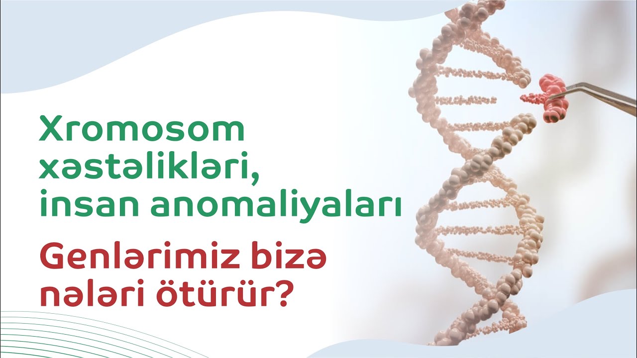 Ən çox rast gəlinən xromosom xəstəlikləri...Daun, Patau, Edvards sindromu və s.