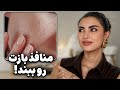 با منافذ بزرگ پوست خداحافظی کن این واقعا جواب می ده