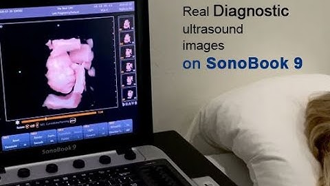 CHISON SonoBook9-Diagnostic ultrasound images