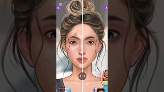 ASMR~Extreme Acne Makeover Transformation🫣🔥 #shorts#asmr#viral#makeup#gaming